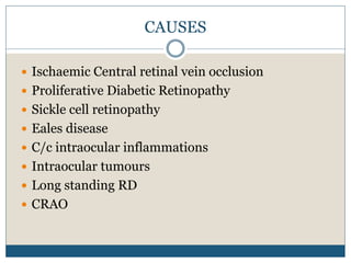 CAUSES
 Ischaemic Central retinal vein occlusion
 Proliferative Diabetic Retinopathy
 Sickle cell retinopathy
 Eales disease
 C/c intraocular inflammations
 Intraocular tumours
 Long standing RD
 CRAO
 