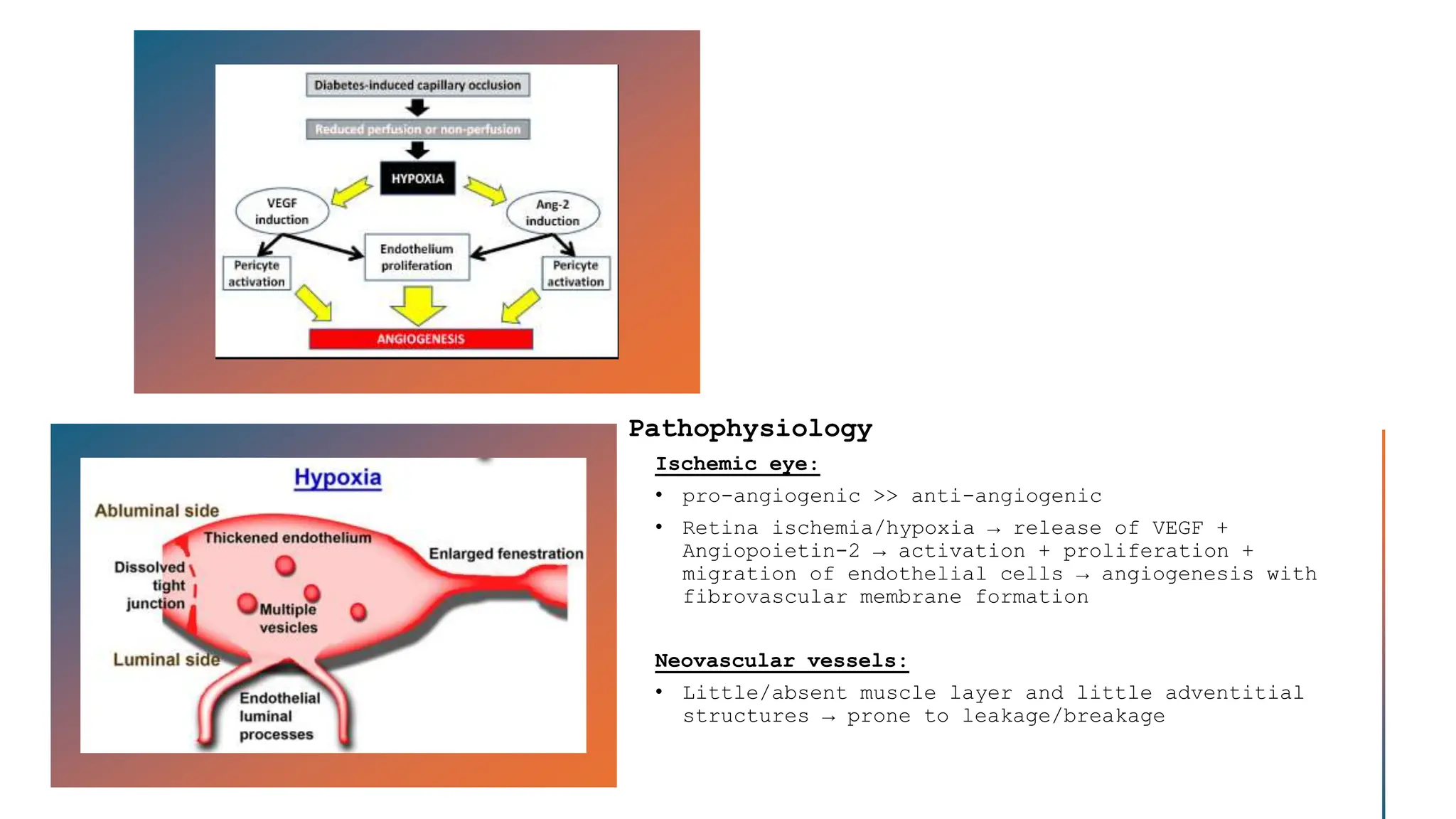 Pathophysiology
Ischemic eye:
• pro-angiogenic >> anti-angiogenic
• Retina ischemia/hypoxia → release of VEGF +
Angiopoietin-2 → activation + proliferation +
migration of endothelial cells → angiogenesis with
fibrovascular membrane formation
Neovascular vessels:
• Little/absent muscle layer and little adventitial
structures → prone to leakage/breakage
 