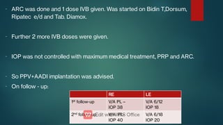 -
-
-
-
-
ARC was done and 1 dose IVB given. Was started on Bidin T,Dorsum,
Ripatec e/d and Tab. Diamox.
Further 2 more IVB doses were given.
IOP was not controlled with maximum medical treatment, PRP and ARC.
So PPV+AADI implantation was advised.
On follow - up:
RE LE
1st
follow-up V/A PL –
IOP 38
V/A 6/12
IOP 18
2nd
follow-up V/A PL-
IOP 40
V/A 6/18
IOP 20
 