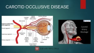 CAROTID OCCLUSIVE DISEASE
 