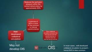 A stenosis of
90% or more
of the common
or internal
carotid arteries
Reduces the perfusion
pressure within the
central retinal artery by
approximately 50%
Poor collateral
circulation between the
internal and external
carotid arteries or
between the two
internal carotid arteries
Well-
developed
collateral
circulation
OIS
OIS
May not
develop OIS
In most cases , well developed
collateral circulation is present –
hence NVG is less common
 