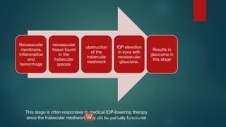 brovascular
membrane,
inammation
and
hemorrhage
neovascular
tissue found
in the
trabecular
spaces
obstruction
of the
trabecular
meshwork
IOP elevation
in eyes with
neovascular
glaucoma.
Results in
glaucoma in
this stage
This stage is often responsive to medical IOP-lowering therapy
since the trabecular meshwork may still be partially functional
 
