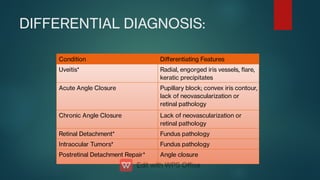 DIFFERENTIAL DIAGNOSIS:
Condition Diﬀerentiating Features
Uveitis* Radial, engorged iris vessels, are,
keratic precipitates
Acute Angle Closure Pupillary block; convex iris contour,
lack of neovascularization or
retinal pathology
Chronic Angle Closure Lack of neovascularization or
retinal pathology
Retinal Detachment* Fundus pathology
Intraocular Tumors* Fundus pathology
Postretinal Detachment Repair* Angle closure
 