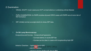 1.
1.
2.
3.
2. Examination:
VISUAL ACUITY: most cases poor D/T corneal edema or underlying retinal disease
PUPIL EXAMINATION: for RAPD, studies showed CRVO cases with RAPD are at more risk of
NVI formation
IOP: initially normal, as angle starts to close, IOP rises.
On Slit Lamp Biomicroscopy:
Conjunctiva and Cornea: - Conjunctival hyperamia
- Corneal edema: in acute IOP rise
- Cornea can be clear in cases with longstanding high IOP
Anterior Chamber: - hyphema due to NVI,
- mild AC reaction
 