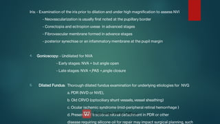4.
5.
Iris: - Examination of the iris prior to dilation and under high magnication to assess NVI
- Neovascularization is usually rst noted at the pupillary border
- Corectopia and ectropion uveae in advanced stages
- Fibrovascular membrane formed in advance stages
- posterior synechiae or an infammatory membrane at the pupil margin
Gonioscopy: - Undilated for NVA
- Early stages: NVA + but angle open
- Late stages: NVA +,PAS +,angle closure
Dilated Fundus: Thorough dilated fundus examination for underlying etiologies for NVG
a. PDR (NVD or NVE),
b. Old CRVO (optociliary shunt vessels, vessel sheathing)
c. Ocular ischemic syndrome (mid-peripheral retinal hemorrhage )
d. Presence of tractional retinal detachment in PDR or other
disease requiring silicone oil for repair may impact surgical planning, such
 