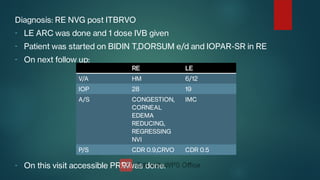 -
-
-
-
Diagnosis: RE NVG post ITBRVO
LE ARC was done and 1 dose IVB given
Patient was started on BIDIN T,DORSUM e/d and IOPAR-SR in RE
On next follow up:
On this visit accessible PRP was done.
RE LE
V/A HM 6/12
IOP 28 19
A/S CONGESTION,
CORNEAL
EDEMA
REDUCING,
REGRESSING
NVI
IMC
P/S CDR 0.9,CRVO CDR 0.5
 