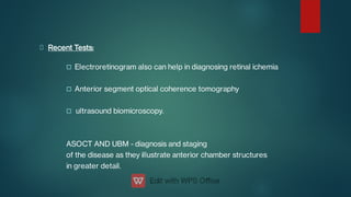 


Recent Tests:
Electroretinogram also can help in diagnosing retinal ichemia
Anterior segment optical coherence tomography
ultrasound biomicroscopy.
ASOCT AND UBM - diagnosis and staging
of the disease as they illustrate anterior chamber structures
in greater detail.
 