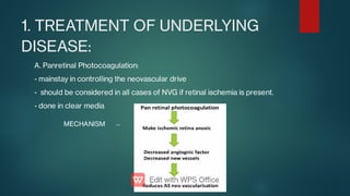 1. TREATMENT OF UNDERLYING
DISEASE:
A. Panretinal Photocoagulation:
- mainstay in controlling the neovascular drive
- should be considered in all cases of NVG if retinal ischemia is present.
- done in clear media
MECHANISM →
 