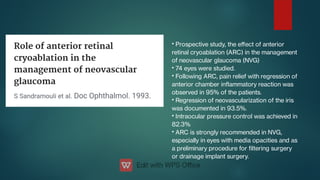 •
•
•
•
•
•
Prospective study, the eﬀect of anterior
retinal cryoablation (ARC) in the management
of neovascular glaucoma (NVG)
74 eyes were studied.
Following ARC, pain relief with regression of
anterior chamber inammatory reaction was
observed in 95% of the patients.
Regression of neovascularization of the iris
was documented in 93.5%.
Intraocular pressure control was achieved in
82.3%
ARC is strongly recommended in NVG,
especially in eyes with media opacities and as
a preliminary procedure for ltering surgery
or drainage implant surgery.
 