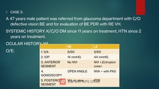 CASE 3:
A 47 years male patient was referred from glaucoma department with C/O
defective vision BE and for evaluation of BE PDR with RE VH.
SYSTEMIC HISTORY: K/C/O DM since 11 years on treatment, HTN since 2
years on treatment.
OCULAR HISTORY: NIL
O/E:
RE LE
1. V/A 5/60 5/60
2. IOP 14 mmHG 44 mmHG
3. ANTERIOR
SEGMENT
No NVI NVI +,Ectropion
uvea+
4.
GONIOSCOPY
OPEN ANGLE NVA + with PAS
5. POSTERIOR
SEGMENT
VH, no view PDR
 