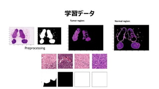 学習データ
Preprocessing
 
