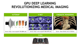 V-NET CINEMATIC RENDERINGAUTOMAP
GPU DEEP LEARNING
REVOLUTIONIZING MEDICAL IMAGING
CUDA
Source: https://arxiv.org/pdf/1704.08841.pdf Source: https://arxiv.org/pdf/1606.04797.pdf Source: Elliot Fishman, M.D. & Siemens
 