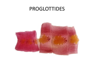 [Micro] cestodes | PPTX