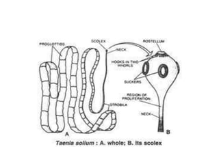 [Micro] cestodes | PPTX