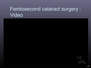 Femtosecond cataract surgery :
Video

106

 