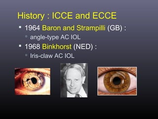 History : ICCE and ECCE
 1964 Baron and Strampilli (GB) :
 angle-type AC IOL

 1968 Binkhorst (NED) :
 Iris-claw AC IOL

 