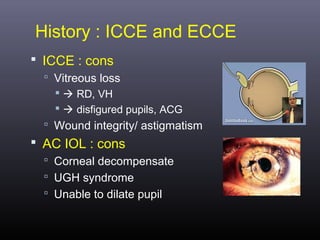 History : ICCE and ECCE
 ICCE : cons
 Vitreous loss
  RD, VH

  disfigured pupils, ACG
 Wound integrity/ astigmatism

 AC IOL : cons
 Corneal decompensate
 UGH syndrome
 Unable to dilate pupil

 
