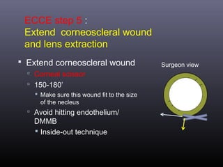 ECCE step 5 :
Extend corneoscleral wound
and lens extraction
 Extend corneoscleral wound
 Corneal scissor
 150-180’
 Make sure this wound fit to the size
of the necleus

 Avoid hitting endothelium/

DMMB
 Inside-out technique

Surgeon view

 
