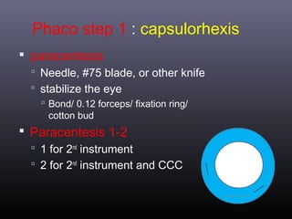 Phaco step 1 : capsulorhexis
 paracentesis
 Needle, #75 blade, or other knife
 stabilize the eye
 Bond/ 0.12 forceps/ fixation ring/
cotton bud

 Paracentesis 1-2
 1 for 2nd instrument
 2 for 2nd instrument and CCC

 