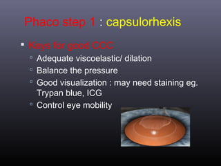 Phaco step 1 : capsulorhexis
 Keys for good CCC
 Adequate viscoelastic/ dilation
 Balance the pressure
 Good visualization : may need staining eg.

Trypan blue, ICG
 Control eye mobility

 