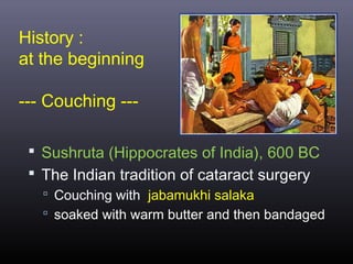 History :
at the beginning
--- Couching -- Sushruta (Hippocrates of India), 600 BC
 The Indian tradition of cataract surgery
 Couching with jabamukhi salaka
 soaked with warm butter and then bandaged

 