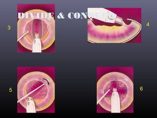 DIVIDE & CONQUER
4

3

5

6

 