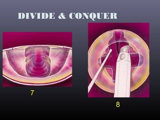 DIVIDE & CONQUER

7
8

 