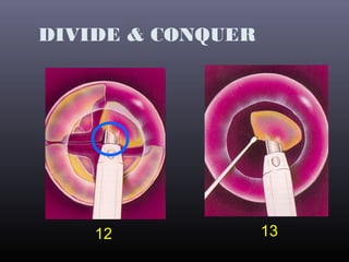 DIVIDE & CONQUER

12

13

 