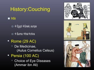History:Couching

 India
  Egypt Greek, europe
  Burma thaichina
 Rome (29 AC)
 De Medicinae,

(Aulus Cornelius Celsus)

 Persia (100 AC)
 Choice of Eye Diseases

(Ammar ibn Ali)

 
