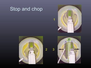 Stop and chop
1

2

3

 