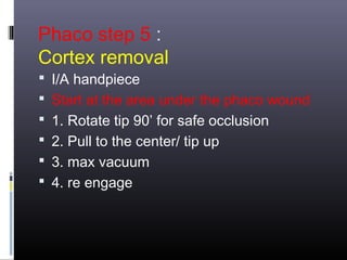 Phaco step 5 :
Cortex removal

 I/A handpiece
 Start at the area under the phaco wound
 1. Rotate tip 90’ for safe occlusion
 2. Pull to the center/ tip up
 3. max vacuum
 4. re engage

 