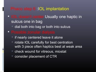 Phaco step 6 :IOL implantation
 IOL doesn't center Usually one haptic in

sulcus one in bag

 dial both into bag or both into sulcus

 Possible zonular dialysis
 if nearly centered leave it alone
 rotate IOL carefully for best centration

with 3 piece often haptics best at weak area
 check wound for vitreous, miostat
 consider placement of CTR

 