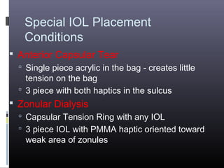 Special IOL Placement
Conditions
 Anterior Capsular Tear
 Single piece acrylic in the bag - creates little

tension on the bag
 3 piece with both haptics in the sulcus

 Zonular Dialysis
 Capsular Tension Ring with any IOL
 3 piece IOL with PMMA haptic oriented toward

weak area of zonules

 