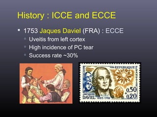 History : ICCE and ECCE
 1753 Jaques Daviel (FRA) : ECCE
 Uveitis from left cortex
 High incidence of PC tear
 Success rate ~30%

 