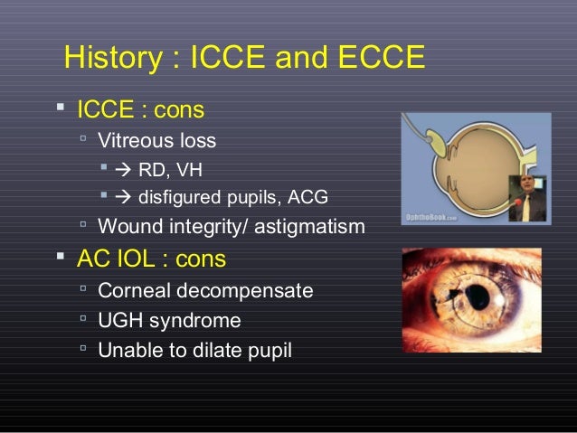 Nw2012 cataract surgery11