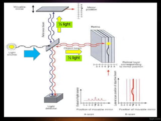 Properties of laser
3. Coherence
• OCT
½ light
½ light
 