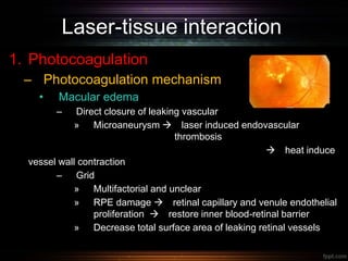 Laser-tissue interaction
1. Photocoagulation
– Photocoagulation mechanism
• Macular edema
– Direct closure of leaking vascular
» Microaneurysm  laser induced endovascular
thrombosis
 heat induce
vessel wall contraction
– Grid
» Multifactorial and unclear
» RPE damage  retinal capillary and venule endothelial
proliferation  restore inner blood-retinal barrier
» Decrease total surface area of leaking retinal vessels
 