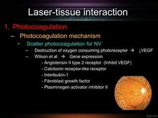Laser-tissue interaction
1. Photocoagulation
– Photocoagulation mechanism
• Scatter photocoagulation for NV
– Destruction of oxygen consuming photoreceptor  ↓VEGF
– Wilson et al.  Gene expression
- Angiotensin II type 2 receptor (Inhibit VEGF)
- Calcitonin receptor-like receptor
- Interleukin-1
- Fibroblast growth factor
- Plasminogen activator inhibitor II
 
