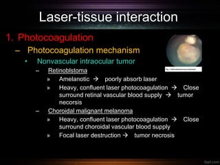 Laser-tissue interaction
1. Photocoagulation
– Photocoagulation mechanism
• Nonvascular intraocular tumor
– Retinoblstoma
» Amelanotic  poorly absorb laser
» Heavy, confluent laser photocoagulation  Close
surround retinal vascular blood supply  tumor
necorsis
– Choroidal malignant melanoma
» Heavy, confluent laser photocoagulation  Close
surround choroidal vascular blood supply
» Focal laser destruction  tumor necrosis
 