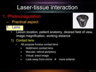 Laser-tissue interaction
1. Photocoagulation
– Practical aspect
1. Lens
• Lesion location, patient anatomy, desired field of view,
image magnification, working distance
1) Contact lens
– All purpose fundus contact lens
» Goldmann contact lens
» Macular, retinal periphery
» Virtual, erect image
» Look away from mirror  more anterior
 