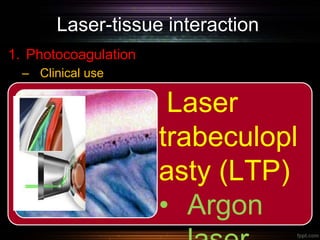 Laser-tissue interaction
1. Photocoagulation
– Clinical use
Laser
trabeculopl
asty (LTP)
• Argon
 