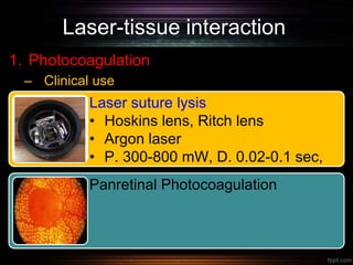 Laser-tissue interaction
1. Photocoagulation
– Clinical use
Laser suture lysis
• Hoskins lens, Ritch lens
• Argon laser
• P. 300-800 mW, D. 0.02-0.1 sec,
Spot size 50-100 µm
Panretinal Photocoagulation
 
