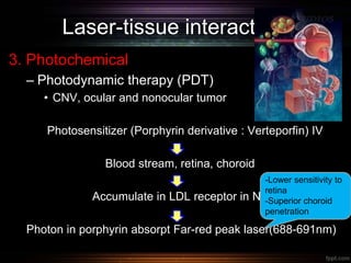 Laser-tissue interaction
3. Photochemical
– Photodynamic therapy (PDT)
• CNV, ocular and nonocular tumor
Photosensitizer (Porphyrin derivative : Verteporfin) IV
Blood stream, retina, choroid
Accumulate in LDL receptor in NV
Photon in porphyrin absorpt Far-red peak laser(688-691nm)
-Lower sensitivity to
retina
-Superior choroid
penetration
 