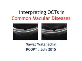 Interpreting OCTs in
Common Macular Diseases
Nawat Watanachai
RCOPT : July 2015
1
 