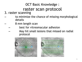 3. raster scanning
– to minimize the chance of missing morphological
details
– 8 mm length scan
– best for vitreomacular adhesion
– May hit small lesions that missed on radial
protocol
11
OCT Basic Knowledge :
raster scan protocol
 