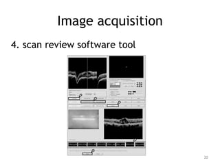 Image acquisition
4. scan review software tool
20
 