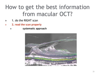 How to get the best information
from macular OCT?
» 1. do the RIGHT scan
» 2. read the scan properly
» systematic approach
21
 