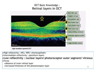 »High reflectivity : NFL/ RPE/ choriocapillatis
»Intermediate reflectivity : plexiform layers
»Low reflectivity : nuclear layers/ photoreceptor outer segment/ vitreous
»Fovea
»Absence of inner retinal layer
»Increased thickness of the photoreceptor layer 26
OCT Basic Knowledge :
Retinal layers in OCT
 