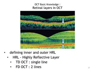 • defining inner and outer HRL
• HRL - Highly Reflective Layer
• TD OCT : single line
• FD OCT : 2 lines 27
OCT Basic Knowledge :
Retinal layers in OCT
 