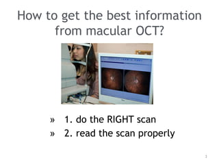 How to get the best information
from macular OCT?
» 1. do the RIGHT scan
» 2. read the scan properly
3
 